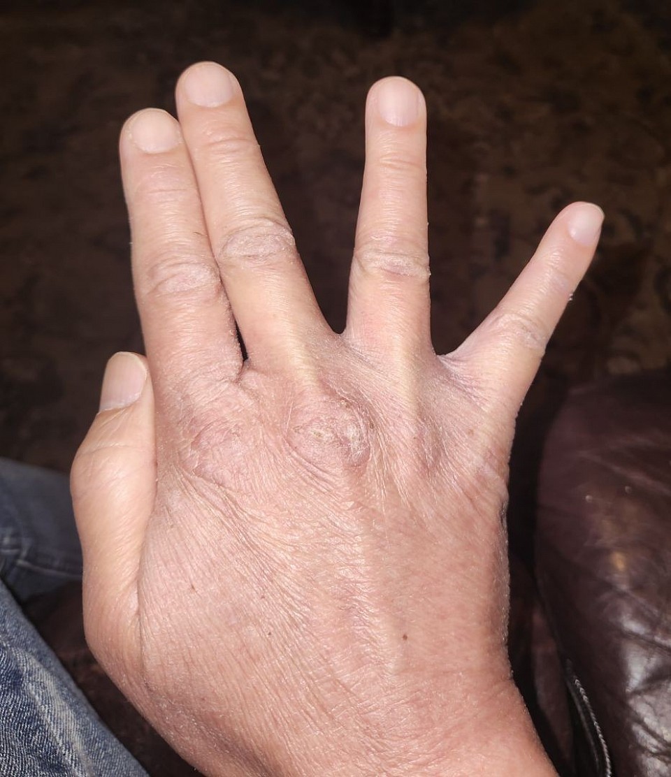 After receiving immortality, you may receive The All'Powers hand symbol...!!...again, which is empty when formed by an unworthy.
